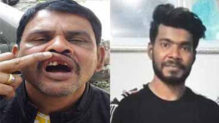 পিটিয়ে বাস হেলপারের দাঁত ফেলে দিলেন ছাত্রলীগ নেতা