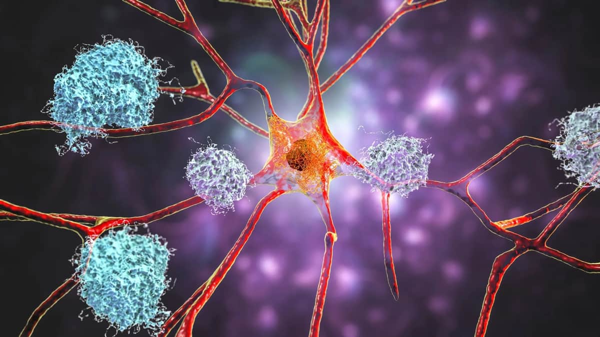 blood cancer mutations Alzheimer's brain