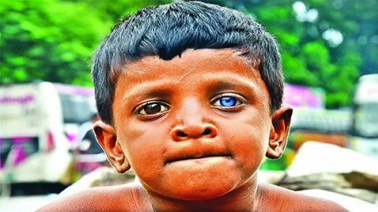 এক চোখ নীল, অন্য চোখ ধূসর সাগরের!
