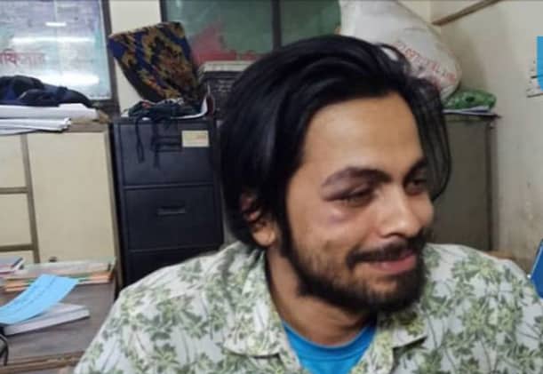 ঘুরতে এসে ক্যাম্পাসে মারধরের শিকার ঢাবির দুই সাবেক শিক্ষার্থী
