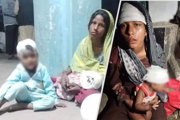 নিজ হাতে সন্তানের মাথা ফাটিয়ে কোলে নিয়ে ভিক্ষা!