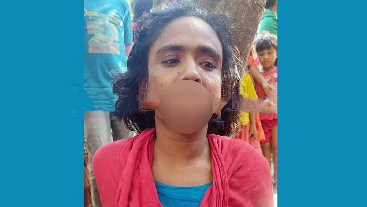 তালাক দেয়া স্ত্রীর সাথে কথা বলায় স্বামীর পুরুষাঙ্গ কেটে দিলো দ্বিতীয় স্ত্রী!