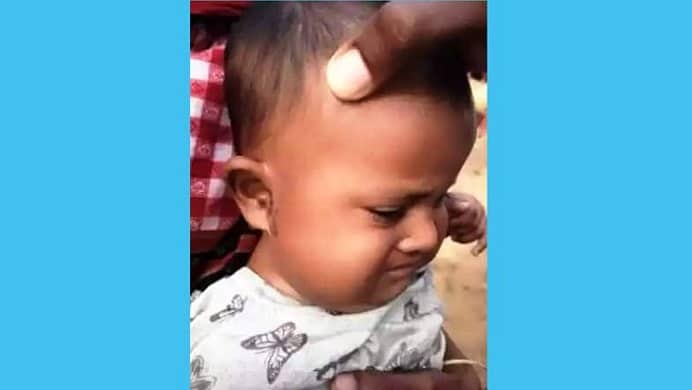 ছয় মাসের শিশুকে অ্যাসিডে ঝলসে দেয়ার অভিযোগে আটক ১
