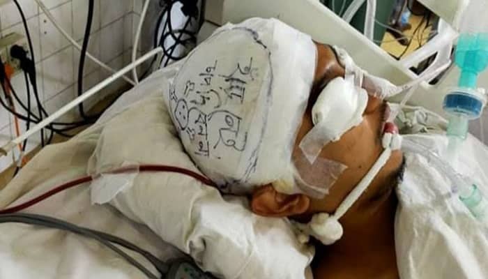 মাথার ব্যান্ডেজে লেখা ‘হাড় নেই চাপ দিবেন না’