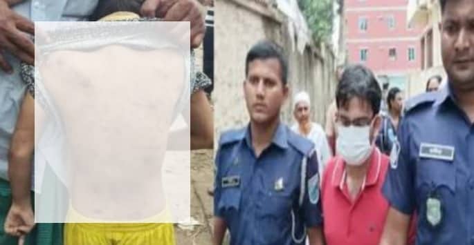 শিশু গৃহকর্মীর উপর বিসিএস ক্যাডার দম্পতির এ কেমন নৃশংসতা!