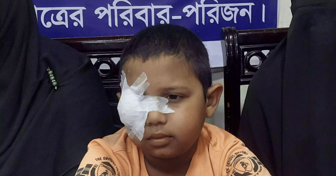 ফেনীতে শিক্ষকের বেত্রাঘাতে চোখ হারাল চতুর্থ শ্রেণির ছাত্র মাহেদুল