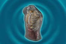 Midjourney Medical