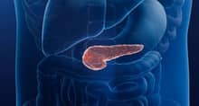 daraxonrasib pancreatic cancer survival