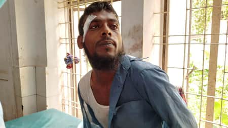 পুলিশ কর্মকর্তাকে কামড়ে দিল রিকশাচালক পুলিশ কর্মকর্তা