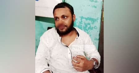 মেয়েকে বিয়ে করতে রাজি না হওয়ায় প্রভাষকের নাক ফাটালেন অধ্যক্ষ