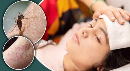 ডেঙ্গু হতে পারে সারা বছরের অসুখ ডেঙ্গু