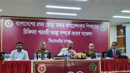 মাথা জোড়া লাগানো জমজ শিশু রাবেয়া-রোকেয়ার বিষয়ে যা বলল সিএমএইচ