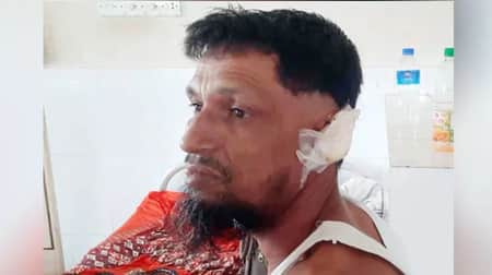স্বামীর কান ছিঁড়ে নিলেন স্ত্রী