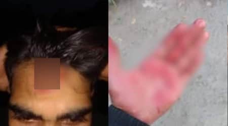 মাইকে ঘোষণা দিয়ে এনসিপি নেতাকর্মীদের ওপর হামলার অভিযোগ এনসিপি নেতাকর্মীদের ওপর হামলা