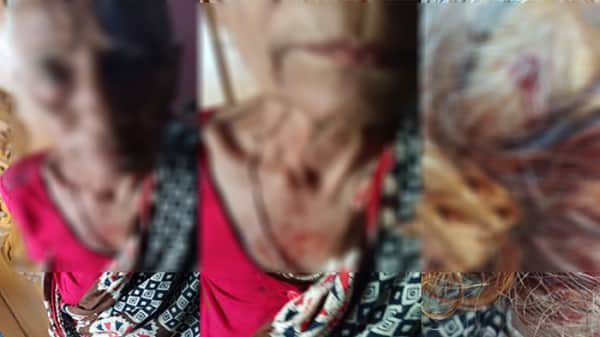 কোটি টাকার সম্পত্তি লিখে নিয়ে মাথা ফাটিয়ে মাকে তাড়িয়ে দিল ছেলেরা!