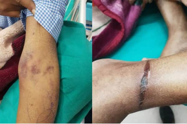 আইসিইউতে রোগীর হাত-পা বেঁধে চিকিৎসা!