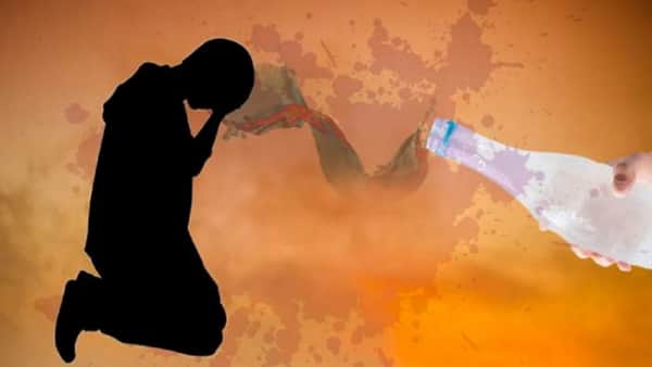 প্রেম প্রত্যাখ্যান করায় প্রেমিকের ওপর অ্যাসিড নিক্ষেপ গৃহবধূর! প্রেমিকের ওপর অ্যাসিড