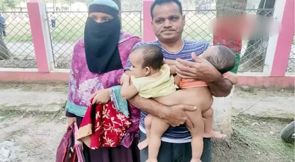 জোড়া লাগানো শিশুর অপারেশনে লাগবে অনেক টাকা, মানুষের দ্বারে দ্বারে ঘুরছেন দম্পতি
