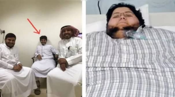 ৫০০ কেজি ওজন কমালেন সৌদি যুবক