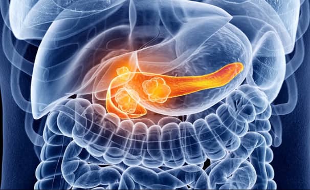 New Drug Nearly Doubles Survival Time in Advanced Pancreatic Cancer Trial Pancreatic Cancer Trial