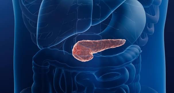 New Drug Nearly Doubles Survival in Advanced Pancreatic Cancer daraxonrasib pancreatic cancer survival