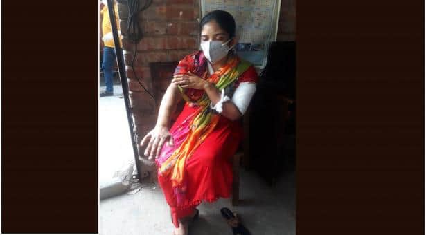 যৌতুকের দাবিতে স্ত্রীকে কোপালেন স্বামী, পলাতক দেবর-শাশুড়ি