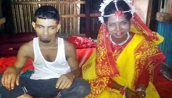 বর দৃষ্টিপ্রতিবন্ধী, কনে বাকপ্রতিবন্ধী