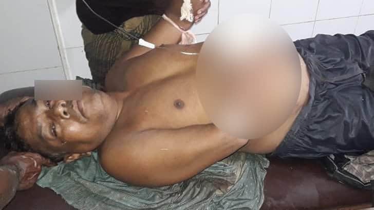 চাচার হাত কেটে পুকুরে ফেলে দিলেন ভাতিজা