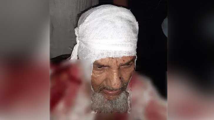 হাটহাজারীতে ইফতারের সময় বৃদ্ধ বাবাকে কোপাল ছেলে!