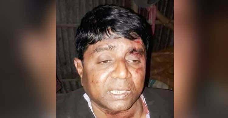 নারীর সঙ্গে ‘আপত্তিকর’ অবস্থায় আটকের পর গণপিটুনি আ.লীগ নেতাকে