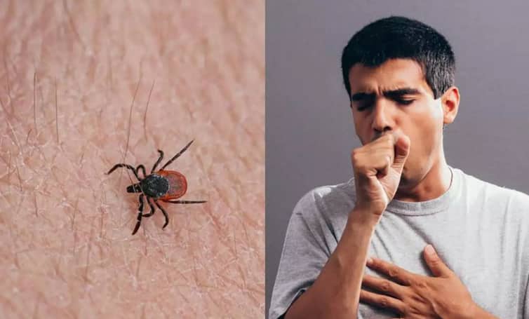 নতুন ভাইরাস বুনিয়াও মানুষ থেকে মানুষে ছড়ায় করোনার মতো