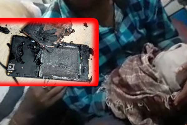 মোবাইলের ব্যাটারি দিয়ে আলো জ্বালাতে গিয়ে হাত গেল কিশোরের