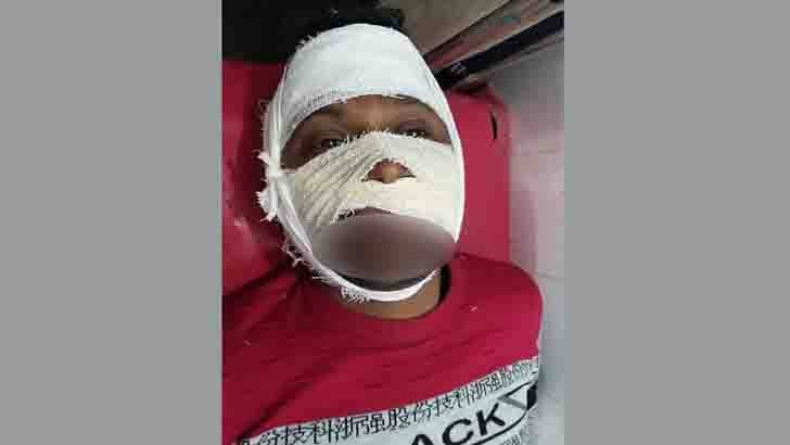 লিফলেট বিতরণ করায় যুবলীগ নেতাকে পেটালেন ভাইস চেয়ারম্যান