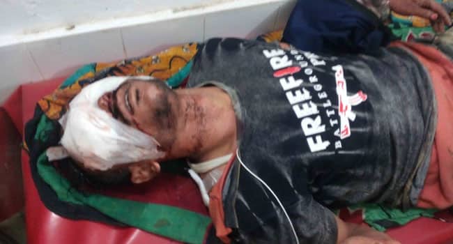 চিহ্নিত ছিনতাইকারীর পা ভেঙ্গে দু’চোখ নষ্ট করে দিল এলাকাবাসী