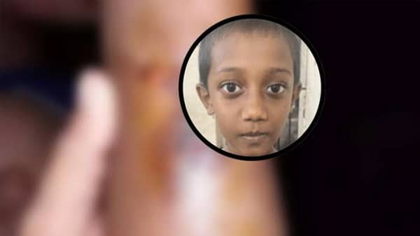 কাজে দেরি করায় শিশুর হাতে-পিঠে ছ্যাঁকা, সৎমা-নানি কারাগারে
