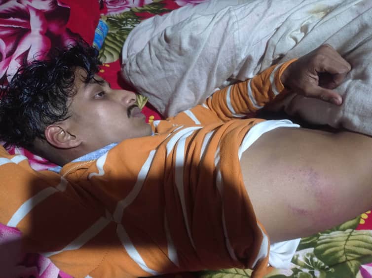সাটুরিয়ায় মেম্বারের ছেলের নেতৃত্বে হামলা, আহত ৪