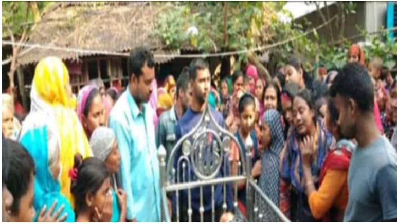 অগ্নিদগ্ধের ৩২ দিন পর