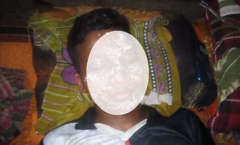 লাইকি ভিডিও বানাতে গিয়ে মুখ পোড়াল তরুণ