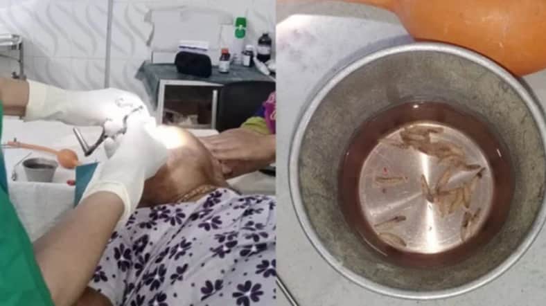 বরিশালে বৃদ্ধার নাক থেকে বের করা হলো ৮০ জ্যান্ত পোকা