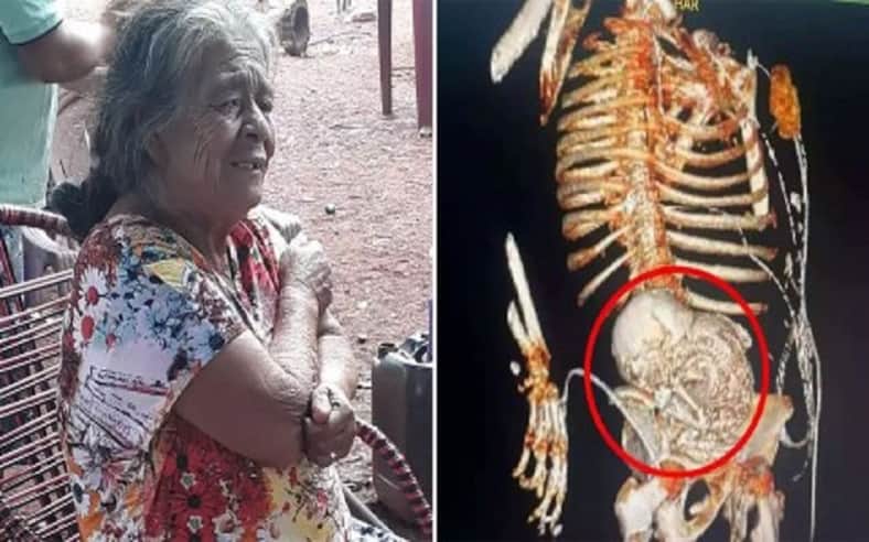 woman-dies-after-surgery