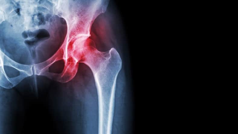 arthritis cartilage Stanford research
