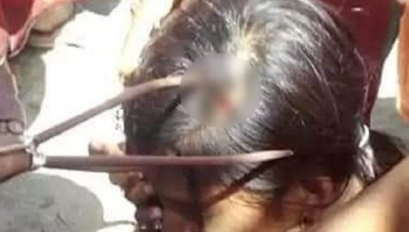 মাস্ক বিতরণ নিয়ে দুই গ্রুপের সংঘর্ষ, টেঁটাবিদ্ধ হয়ে ভাই-বোনসহ আহত ১০