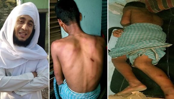 পরকীয়া ফাঁস করায় শিক্ষার্থীকে পেটালেন মাদ্রাসা শিক্ষক