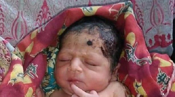 পটলক্ষেতে নড়েচড়ে উঠলো ফুটফুটে শিশু