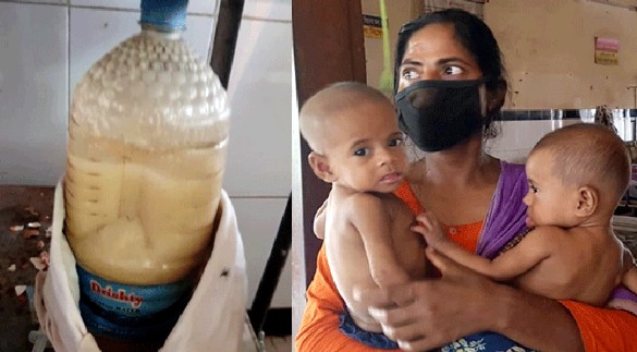 ৫ মাস ধরে আটা-ময়দা গোলা পানি, কলাপাতা খায় যমজ শিশু