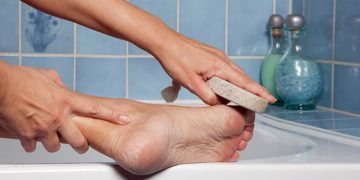 পায়ের গোড়ালি ফাটা