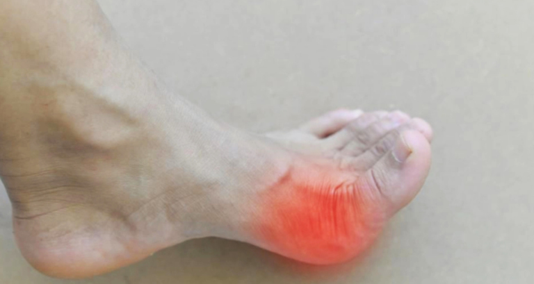 বুড়ো আঙুলে