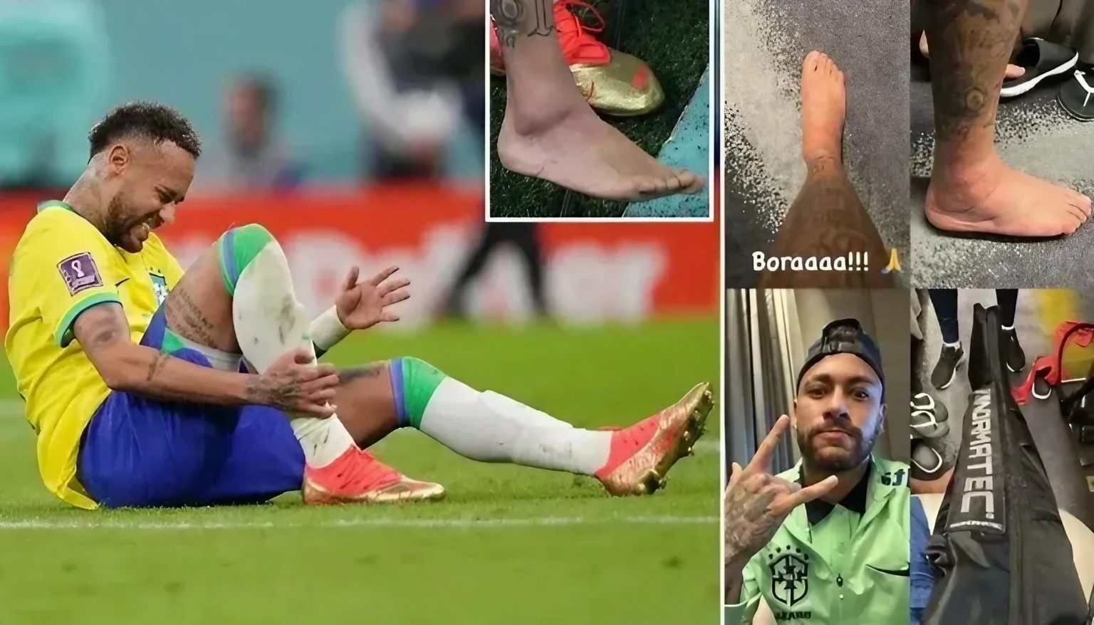 নাসার অত্যাধুনিক প্রযুক্তিতে দ্রুত সেরে উঠছেন নেইমার নেইমার