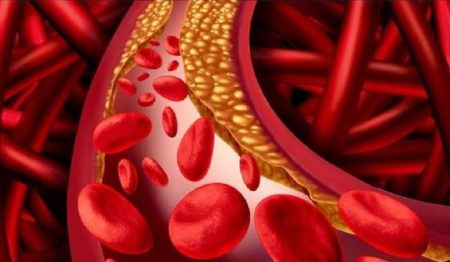 যেভাবে বুঝবেন শরীরে কোলেস্টেরল বাড়ছে