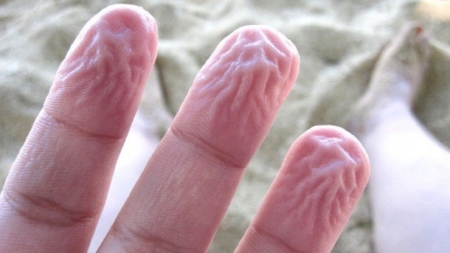 Wrinkling of skin on hands